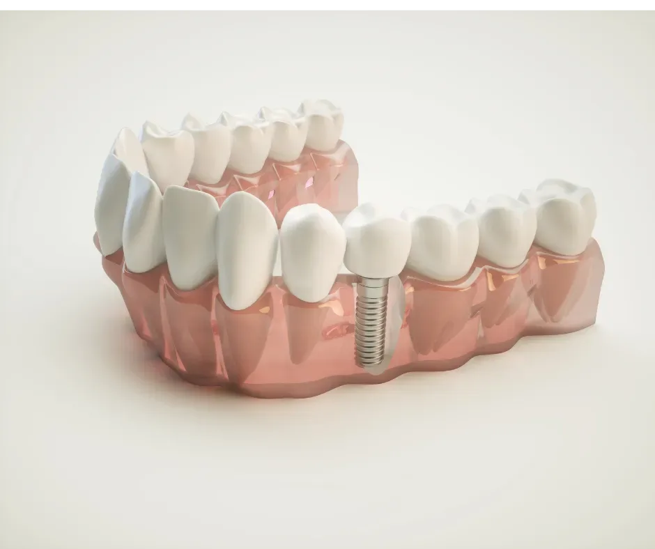 Restorative Dentistry