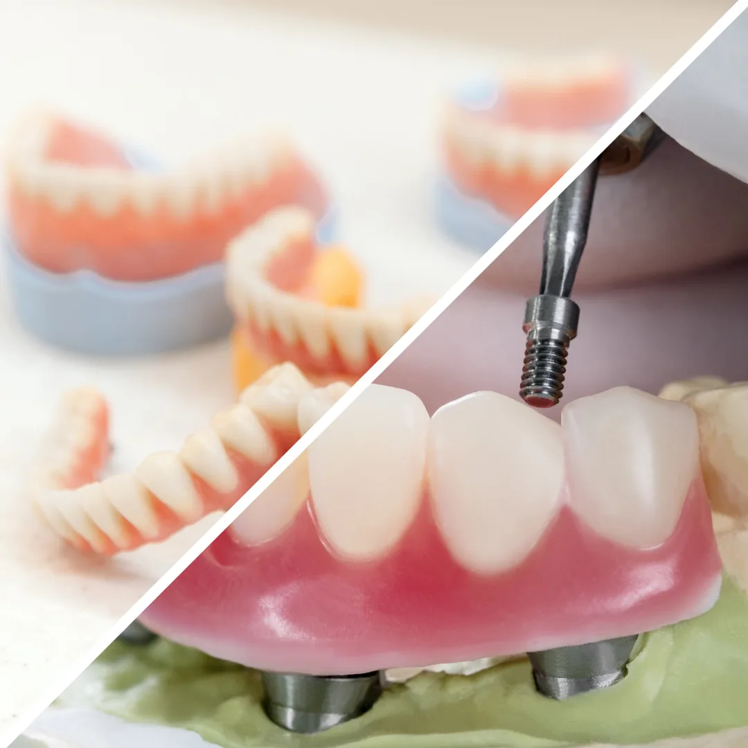 Dental Myths Debunked