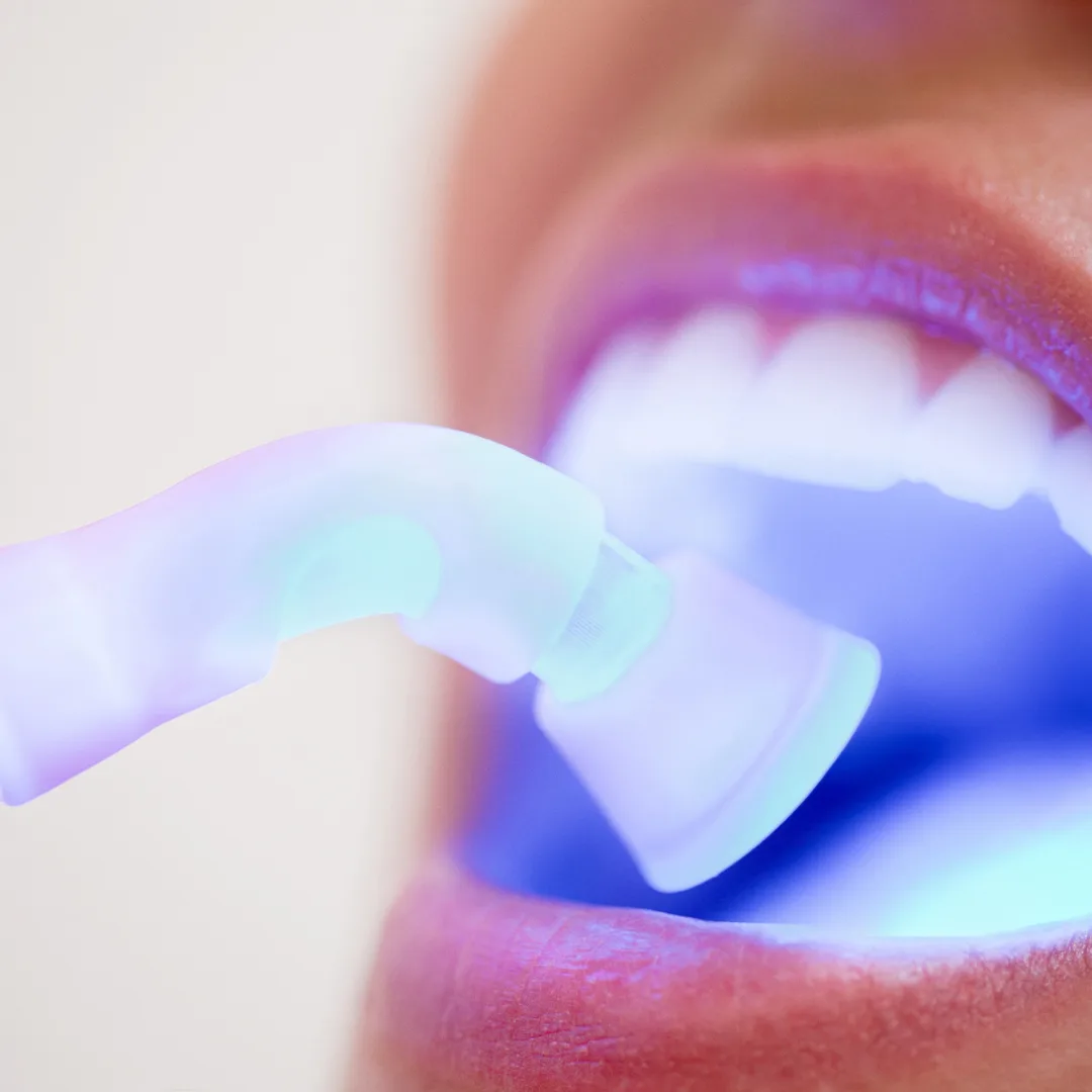 The Hidden Dangers of Plaque and Tartar