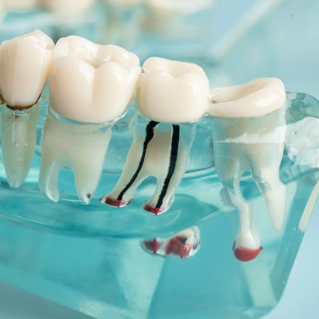 Foods for Healthy Teeth